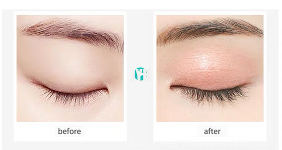Mascara προϊόντων προσοχής Eyelash ορών ώθησης ανυψωτών μαστιγίων βοτανικό